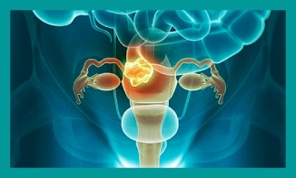 endometriosis treatment london