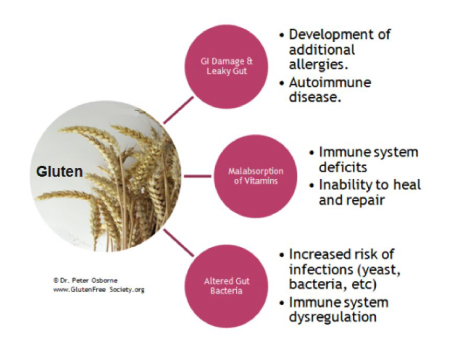 gluten sensitivity is it real