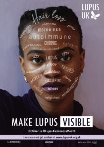 lupus uk treatment