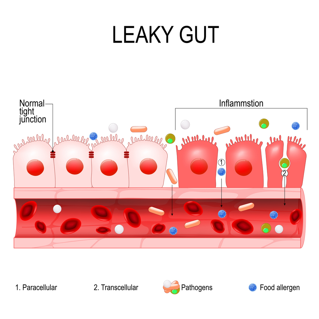 leaky gut specialist harley street